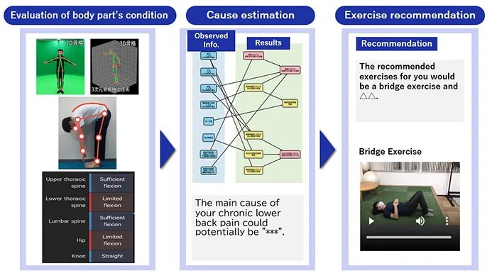 Công nghệ AI của NEC giúp chẩn đoán và điều trị đau lưng